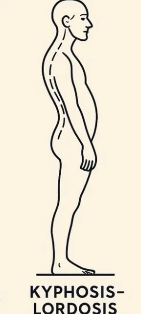 【ストレートネックで反り腰の人】向け運動メニュー