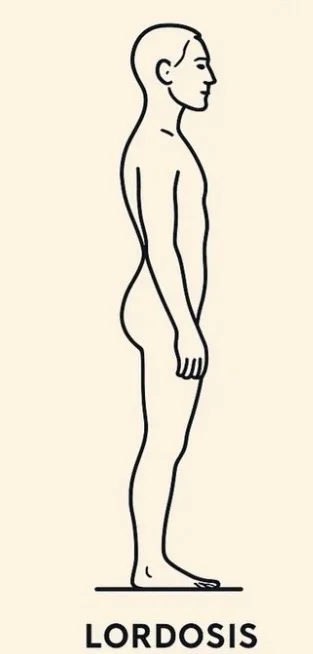【反り腰が気になる人向け】運動メニュー